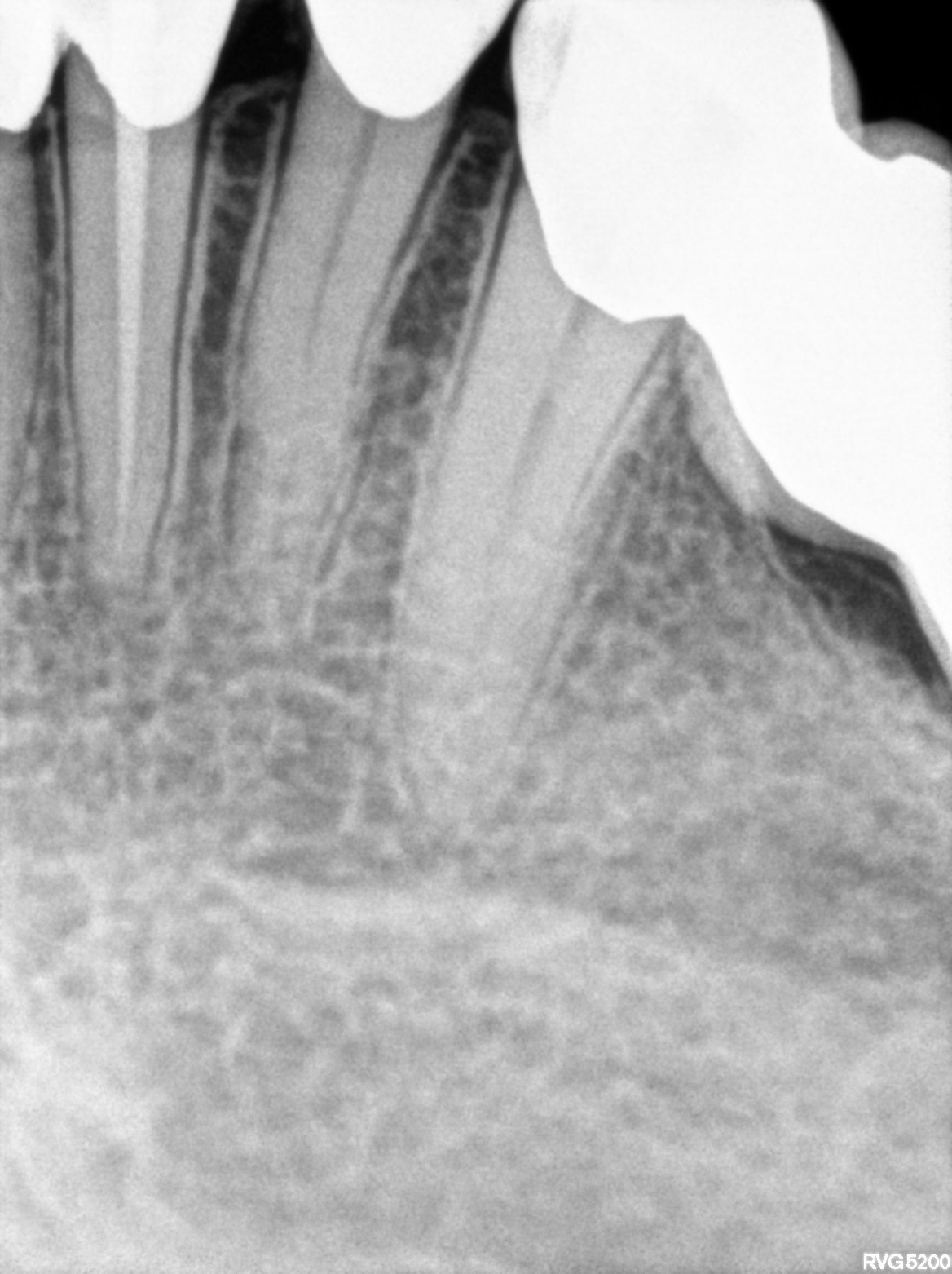 Dental X-ray